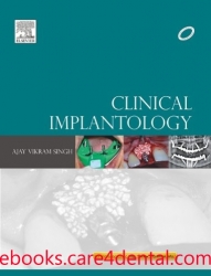Clinical Implantology 1E (pdf)